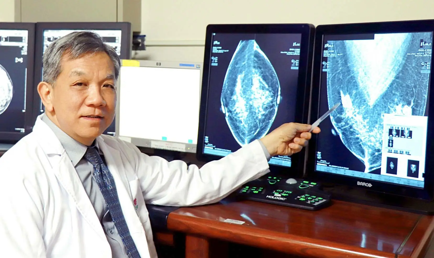 聖馬升級3D乳房攝影同步導入AI　乳癌篩檢更精準舒適