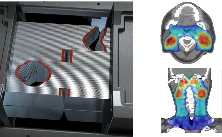 嘉基啟用6D導航弧形刀 高精準放療新設備守護癌友健康 2 134a2a6247b678f